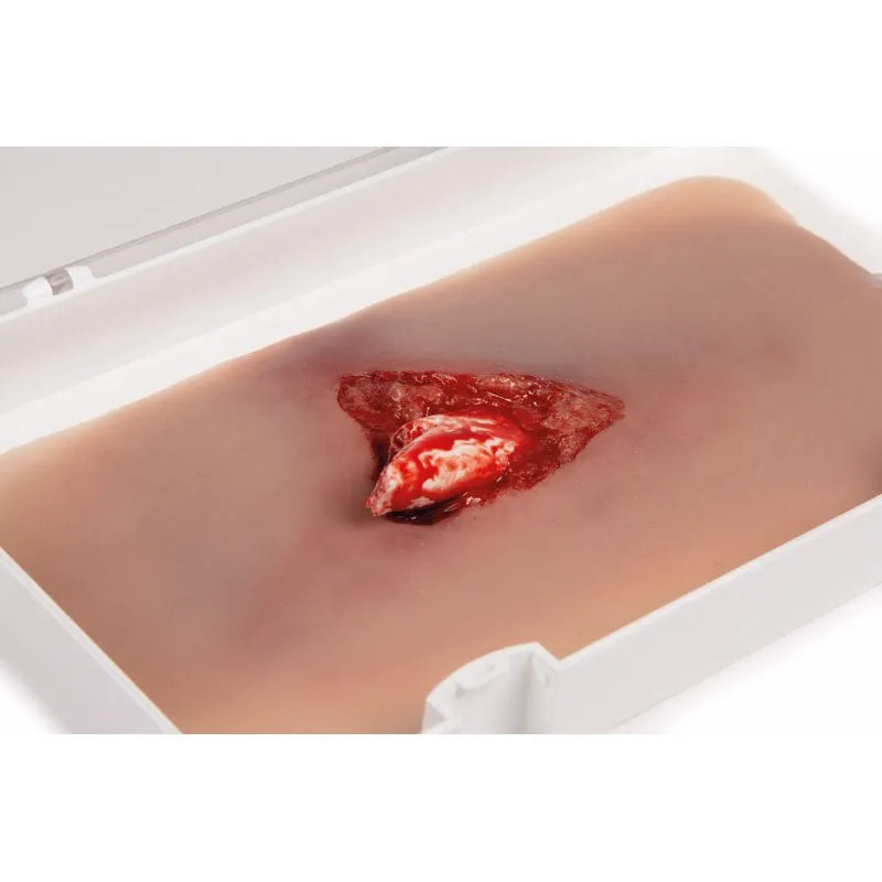 Wound Moulage Open Fracture Kit