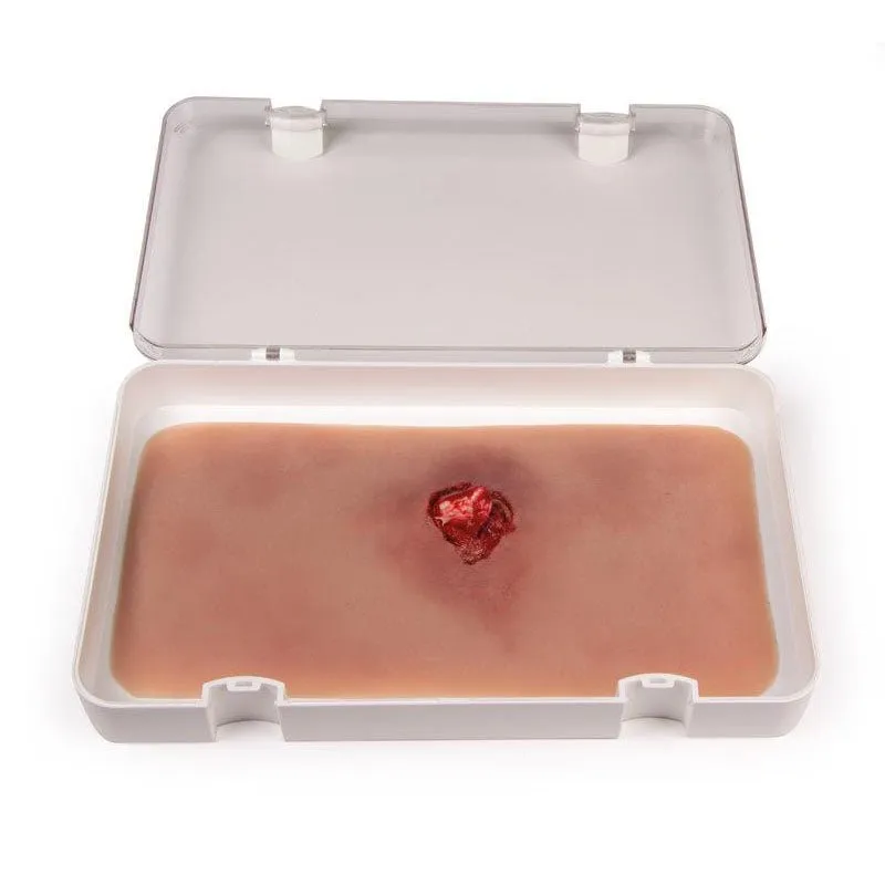 Wound Moulage Open Fracture Kit