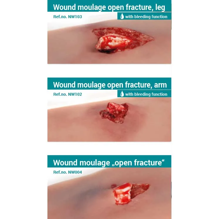 Wound Moulage Open Fracture Kit