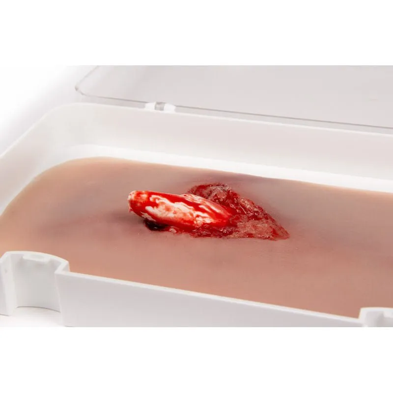 Wound Moulage Open Fracture Kit