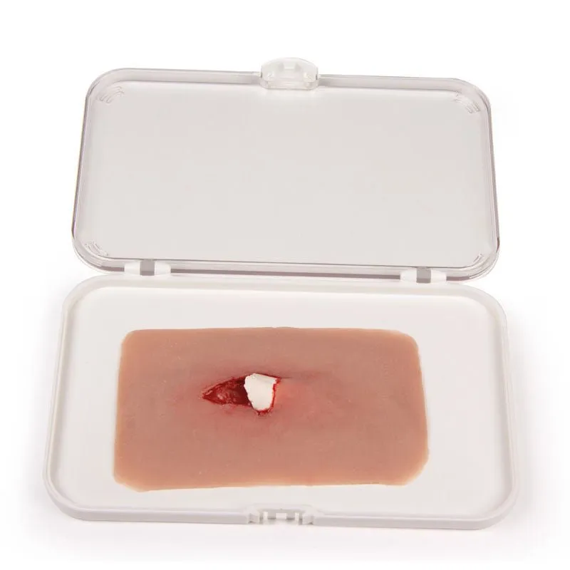 Wound Moulage Open Fracture Kit