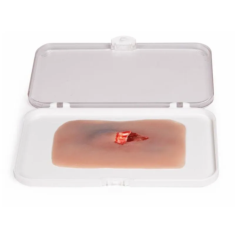 Wound Moulage Open Fracture Kit