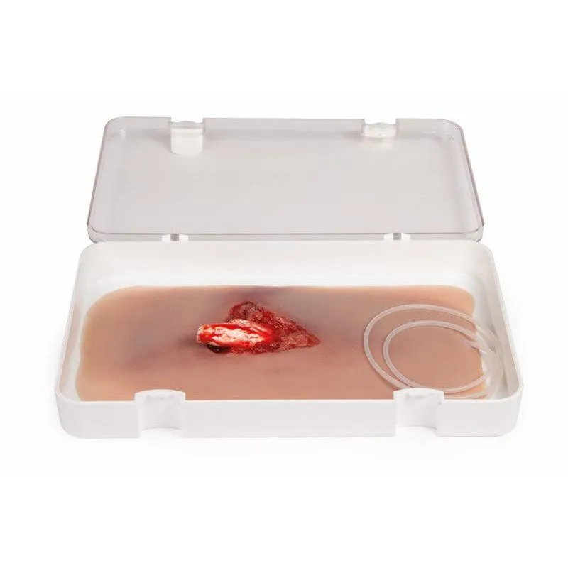 Wound Moulage Open Fracture Kit