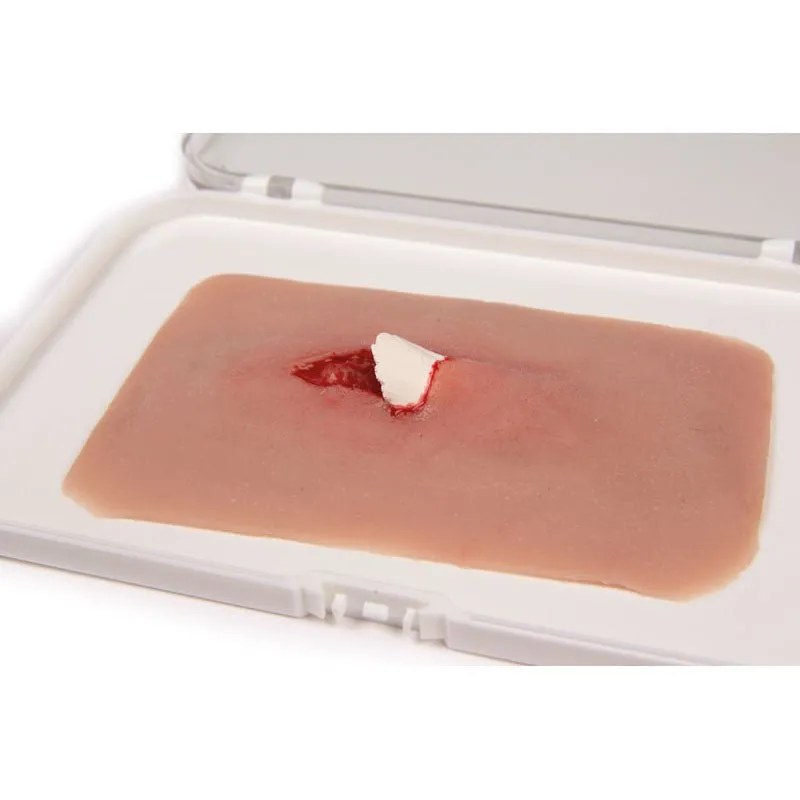 Wound Moulage Open Fracture Kit